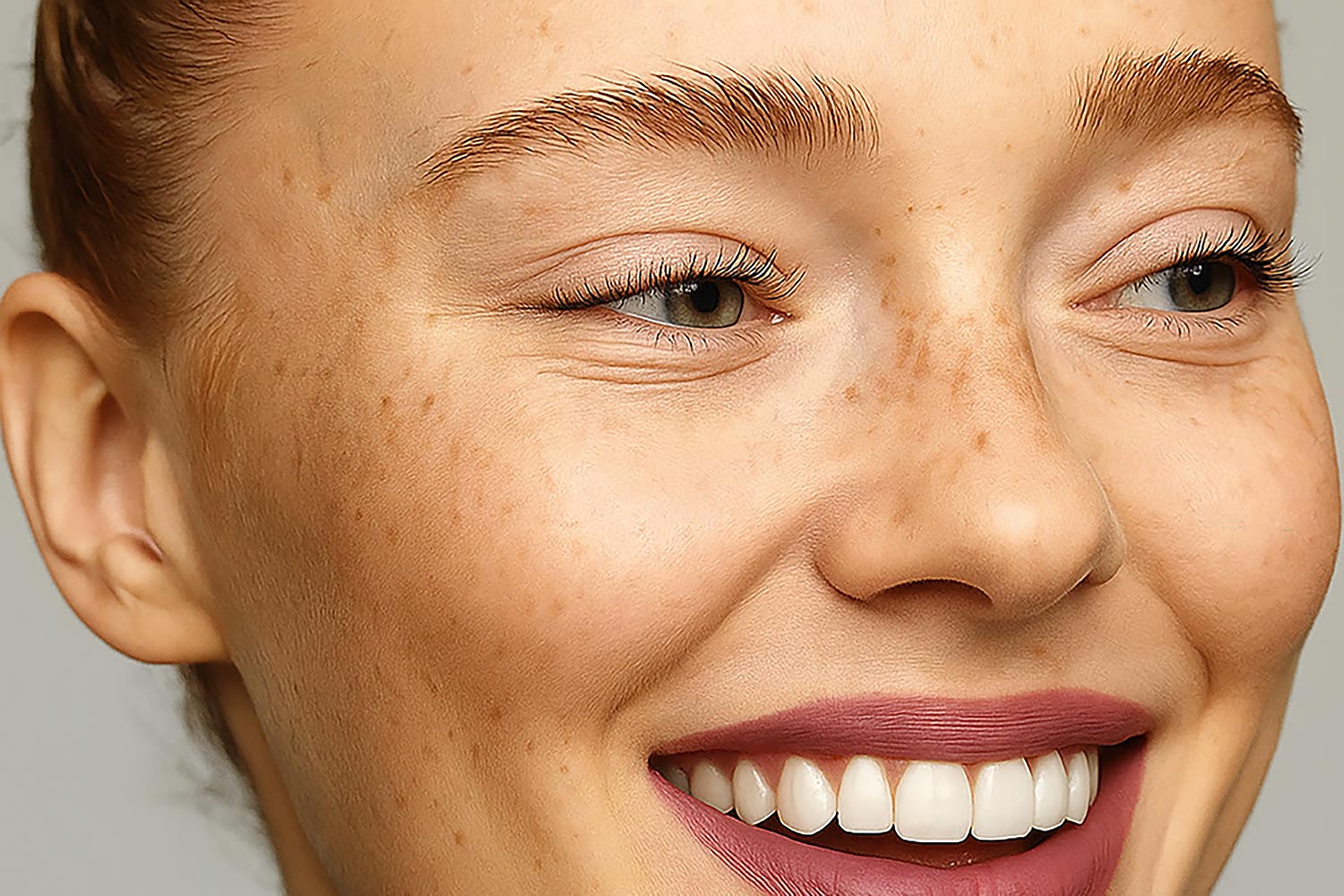 Will ‘Baby Botox’ Prevent Future Wrinkles?