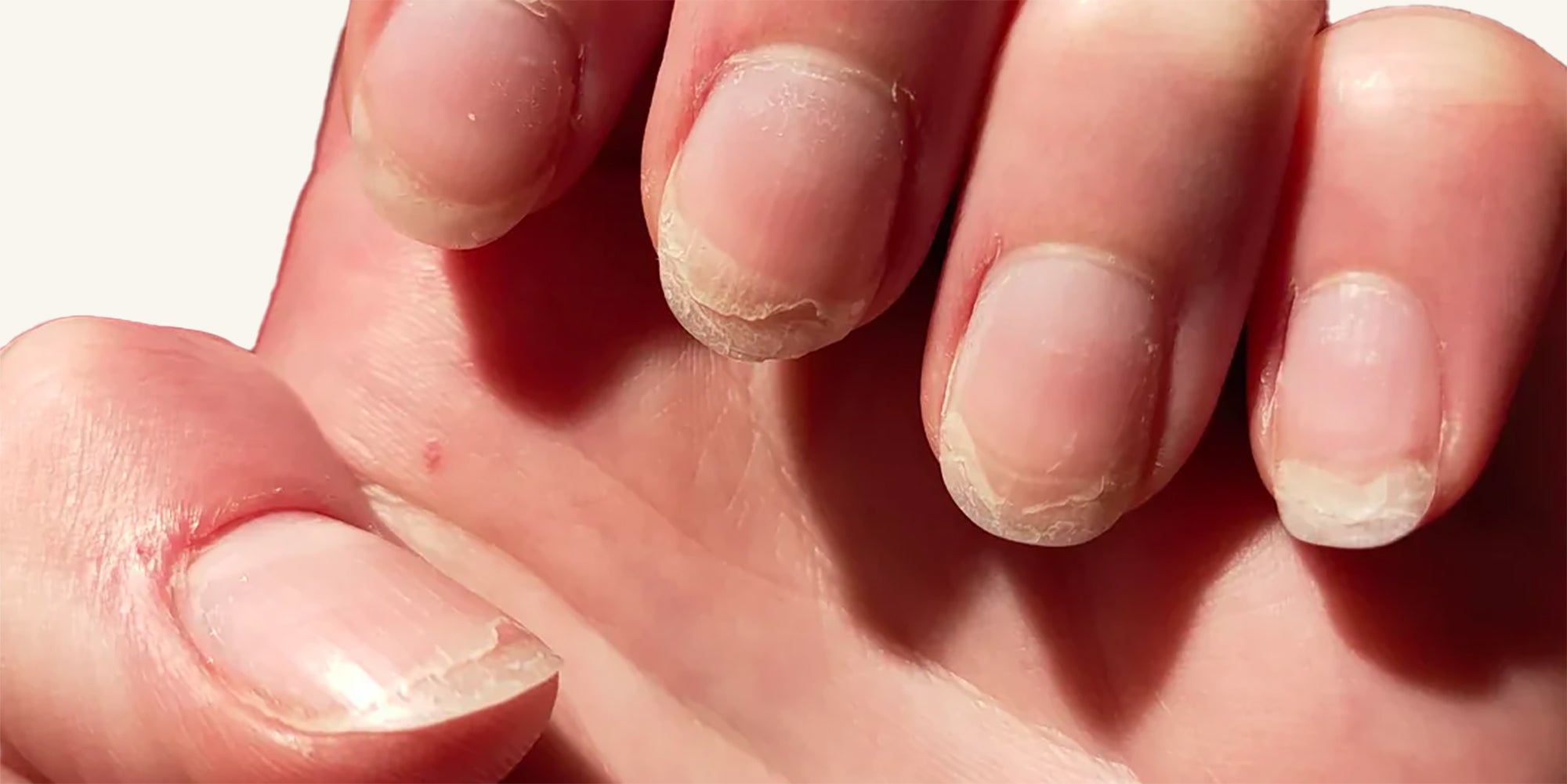 8 Ways to Strengthen Your Nails after Acrylics or Gels